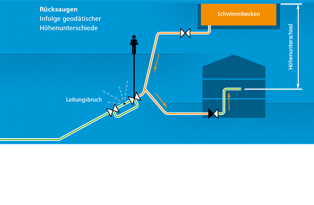 Rücksaugen neu