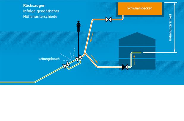 Rücksaugen neu